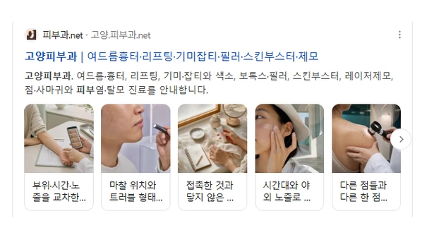 case goyang derma serp